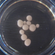 Ten-month-old brain organoids, each about the size of a pea.